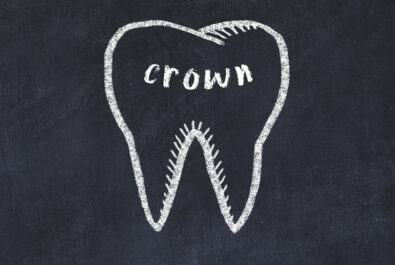 austin dental crowns
