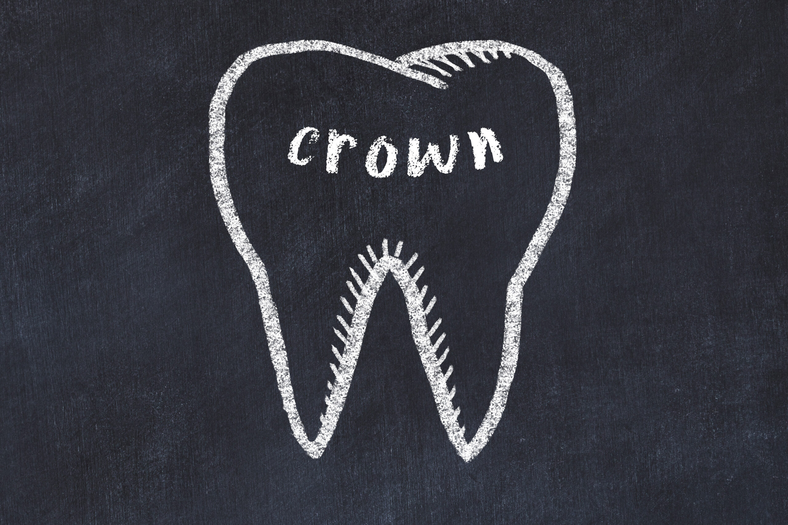 austin dental crowns