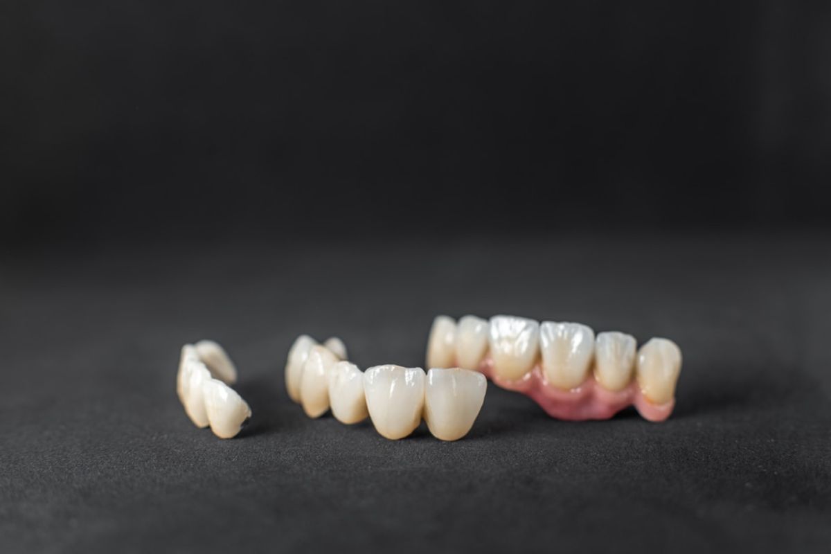 dental crowns prototypes