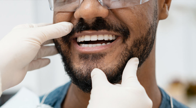 Man with beard smiling while dentist examines his teeth wearing protective gloves and glasses.